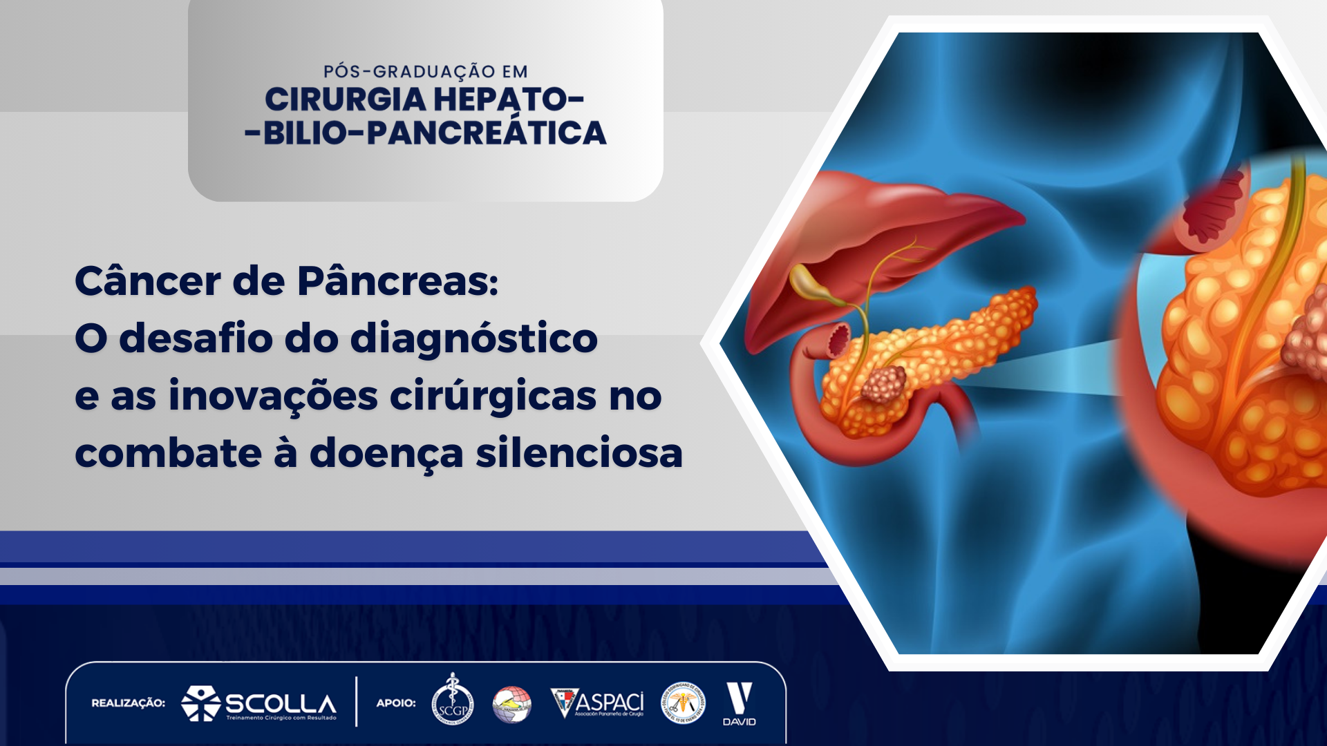 Câncer de Pâncreas: O desafio do diagnóstico e as inovações cirúrgicas no combate à doença silenciosa